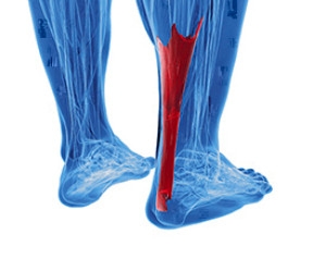 How Achilles Tendon Ruptures Occur