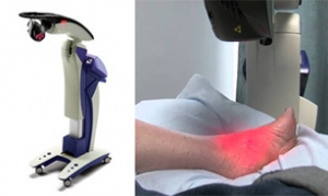 Treating Toenail Fungus