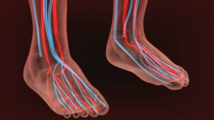 Early Intervention for Poor Foot Circulation